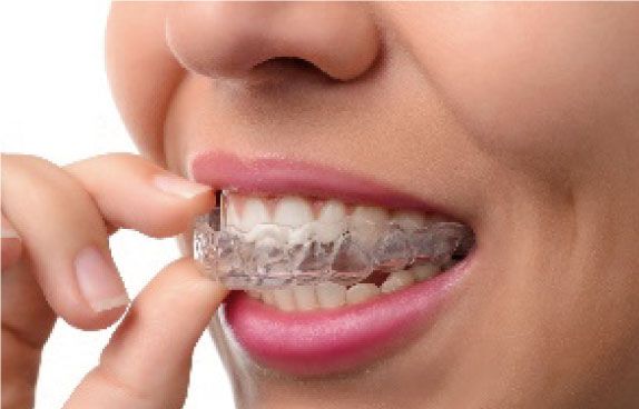 器具の見た目が気になる